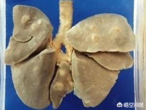 吃蛇肉灵异事件:深圳男子被吃脑虫入侵去世，哪些食物最危险含寄生虫？