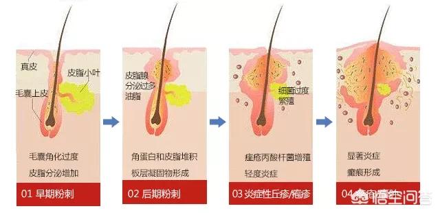 龟鹿补肾丸能长期吃吗，脾肾阳虚吃什么中成药比较好？