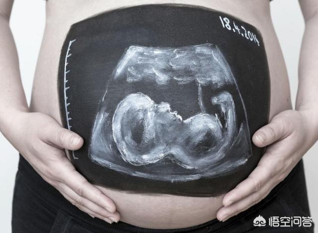 怀孕7个月四维彩超;怀孕7个月四维彩超看男女
