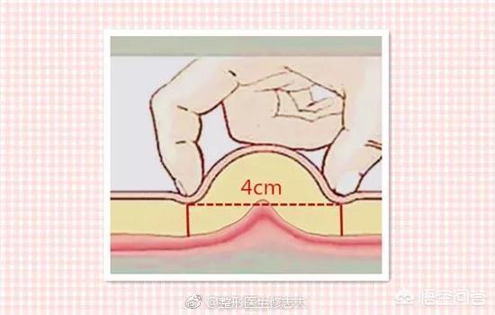 自体脂肪丰胸怎么样-自体脂肪丰胸和假体丰胸哪个好