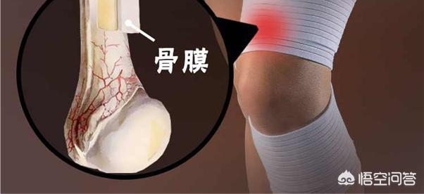 头条问答 骨膜炎怎么处理 16个回答