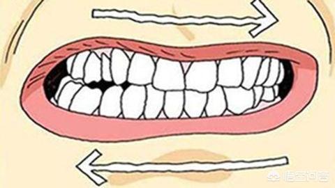睡觉偶尔磨牙是怎么回事:孩子睡觉偶尔磨牙是怎么回事 晚上睡觉磨牙，是怎么回事？
