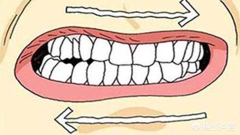 晚上睡觉磨牙是什么原因:睡觉磨牙是什么原因怎么解决？