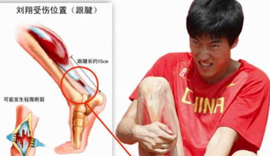 刘翔女友:刘翔当年为什么选择和葛天结合呢？内中的原因你们清楚吗？