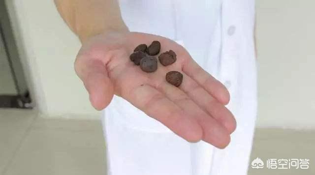 肾结石吃药可以变小吗？