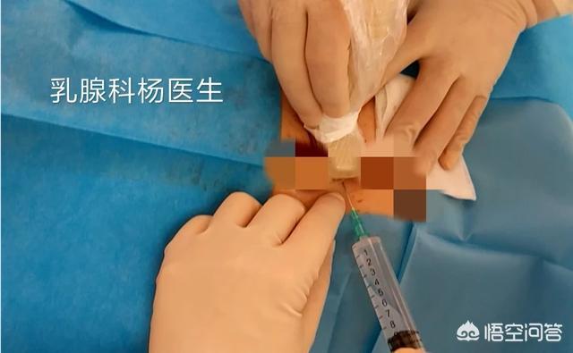 乳腺切除:做乳腺肿瘤切除手术时，麻醉该怎么打？需要注意什么？