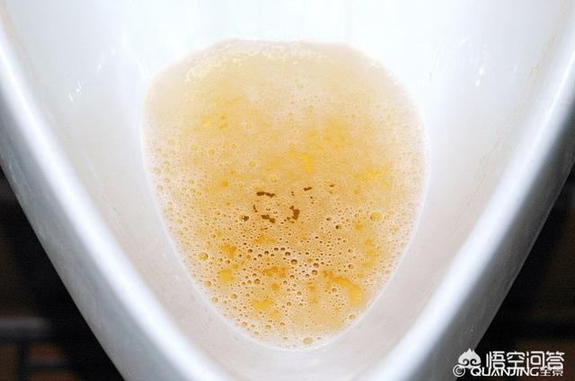 经常食用可增加尿液排出量,促进尿酸排泄.