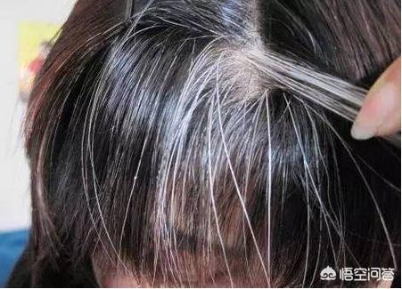 邓超白头发:《从你的全世界路过》邓超怎么白头发
