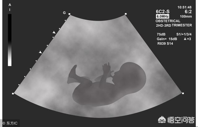怀孕九周做的B超的数据能看出男女吗(怀孕9周孕囊能看出男女)