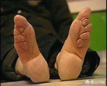 头条问答 古代人为什么缠足 缠足有什么好处 60个回答