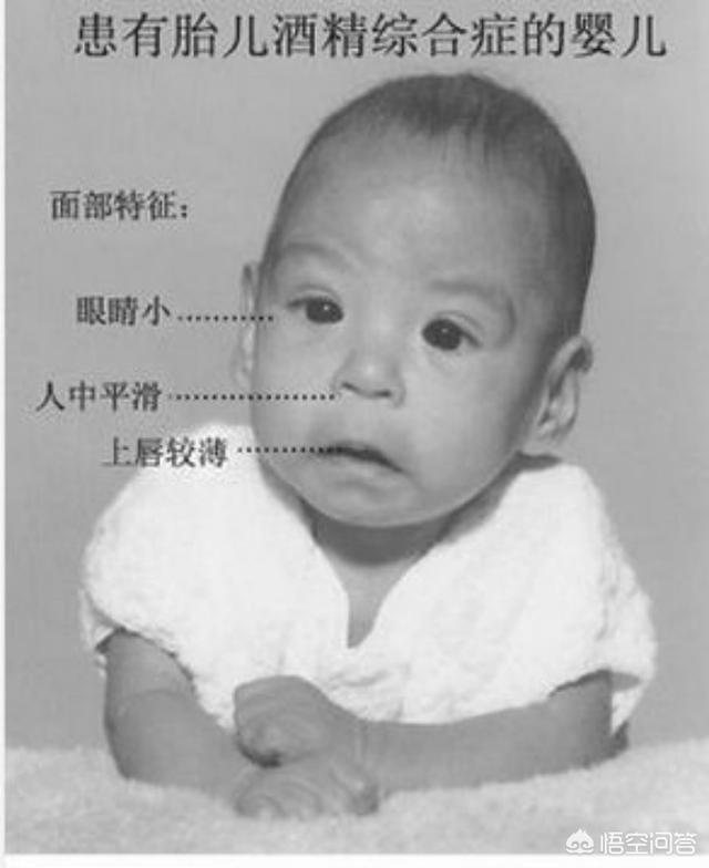 剑鱼图片:有没有比盾牌座uy更大的恒星？