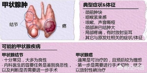 邱晨个人简介:《奇葩说》辩手邱晨自爆患甲状腺癌，你怎么看？治愈的几率大吗？