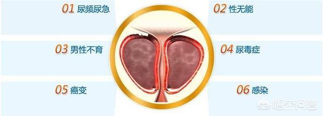 男性按摩壮阳图片，前列腺保养要选对方法，如何正确保养按摩
