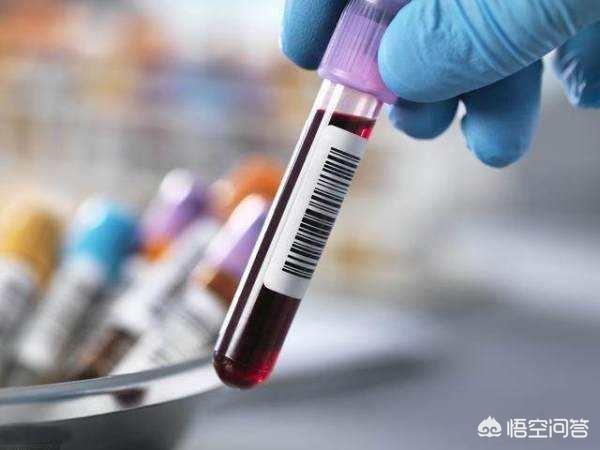 性激素六项主要是查什么:性激素六项主要是查什么项目 性激素6项检查，泌乳素过高，该怎么办？