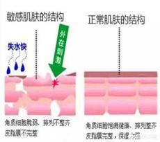 脸部皮肤过敏偏方(脸部皮肤过敏的偏方)