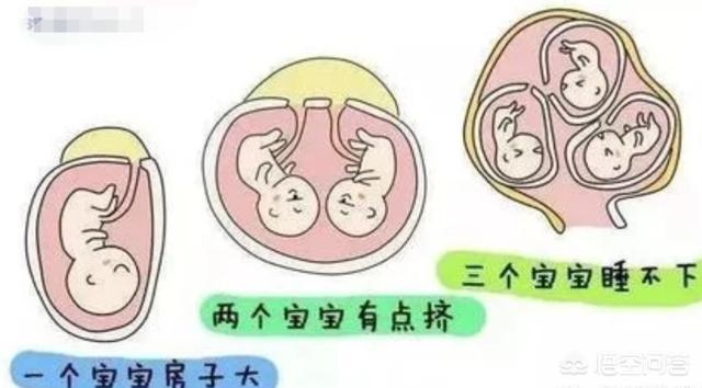 女星怀三胞胎体重升到200斤，朋友体重200斤，已经怀孕3个月，这种身体情况会有风险吗？