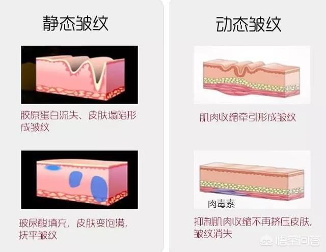 开塞露真的能擦脸吗，1块钱就能买到的开塞露，真的能当护肤品使用吗