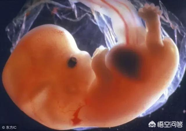 仍然看不见胎心胎芽怎么办，怀孕两个月，检查没有胎心胎芽，只有个空壤这是什么情况