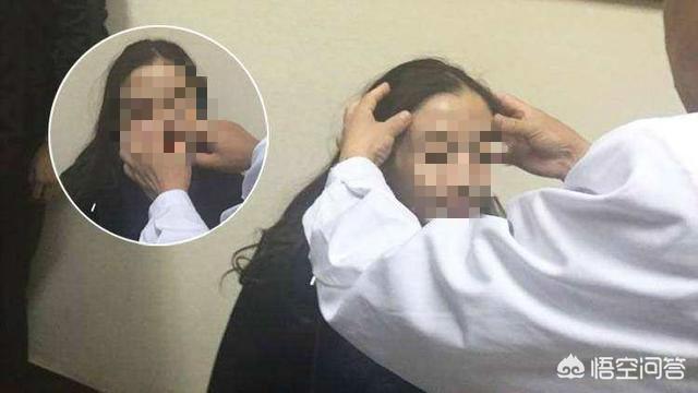 孙娜恩整容:双眼皮有哪几种类型，如何选择适合自己的双眼皮类型