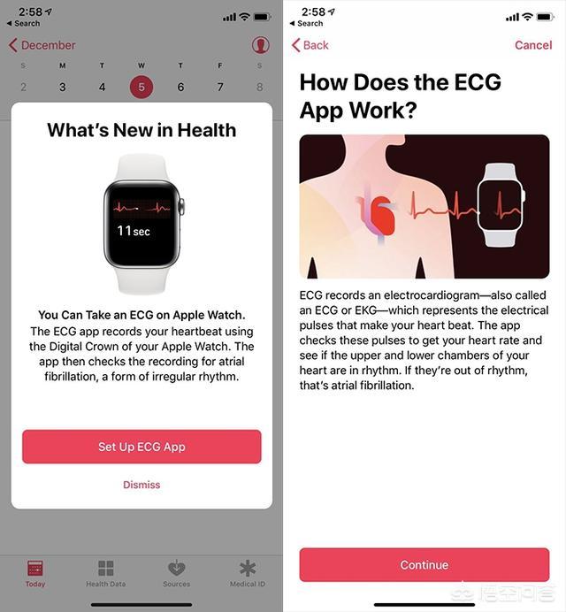 苹果手表有测血糖功能吗，国行Apple Watch4有没有心电图的检测功能呢你怎么看