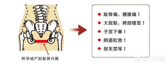 耻骨图片:耻骨图片位置图 怀孕后