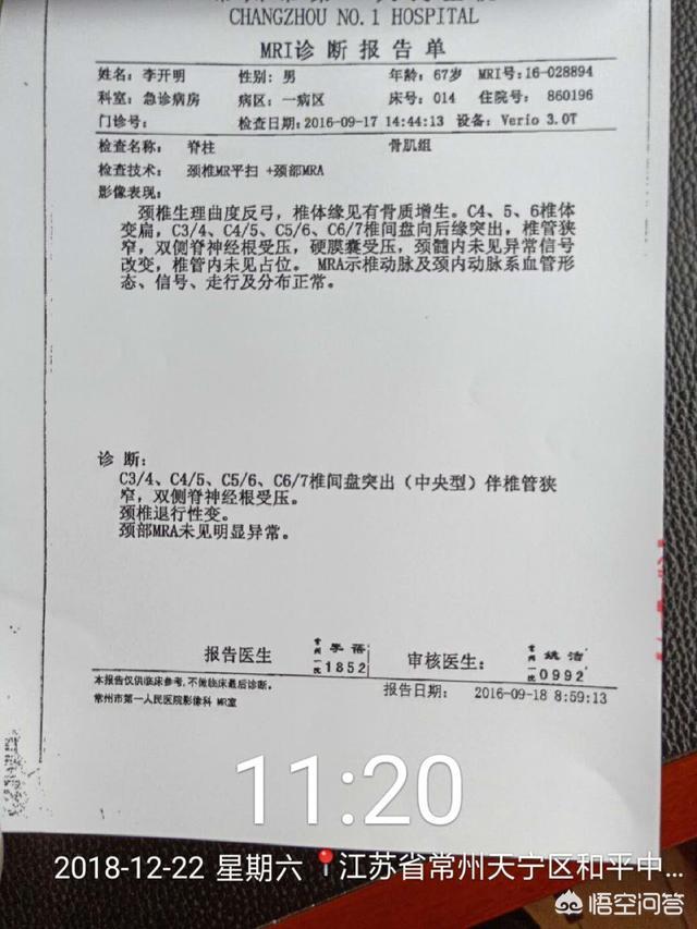 臂丛神经炎能治好吗:新生儿臂从神经损伤能治好吗？
