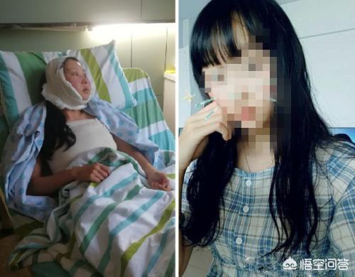 道晖芝整容失败:如何看待驻马店一女孩整形失败，“医院”：可再整，不赔偿 ？