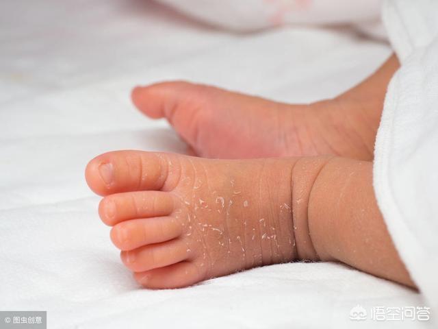 新生儿脱皮是怎么回事，宝宝出生七天了，但是皮肤干燥且有点脱皮是怎么回事