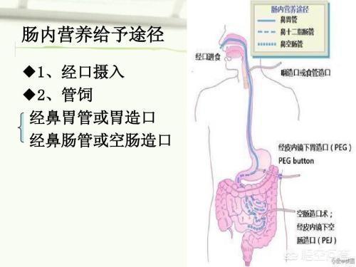 胃癌术后肠梗阻怎么办:胃癌术后小肠梗阻怎么办 胃癌手术后一星期没排便正常吗？