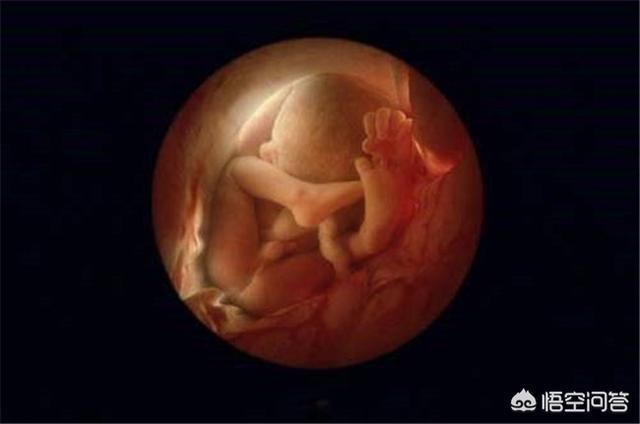 怀孕7个月四维彩超,七个月胎儿四维彩超图片