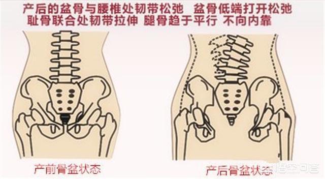 产后恶露是什么:产后恶露是什么样正常 产后怎么做能尽快排干净恶露，促进子宫尽快恢复？