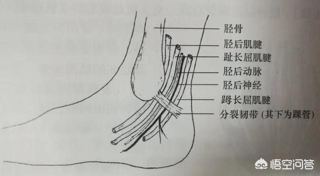 怎样确定筋膜炎，脚踝筋膜炎、脚踝滑膜炎和痛风要怎样区别