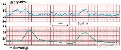 胎心率越低是不是男孩机率越大？