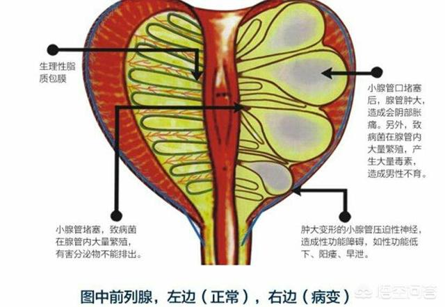 左氧氟沙星穿透前列腺图片