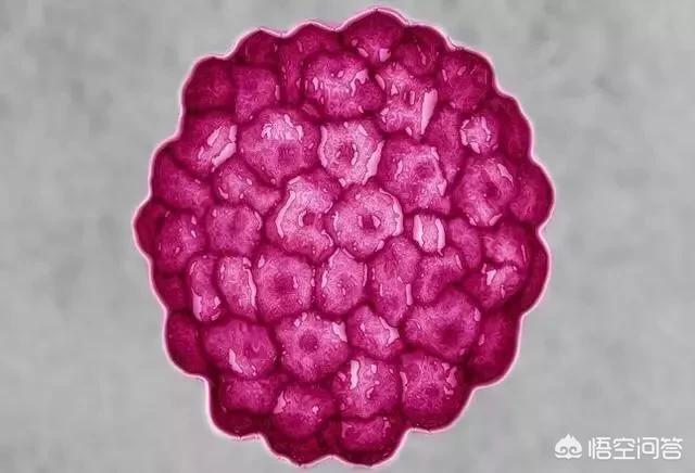 调教女犬大腿环阴环阴链电影:HPV是什么？和宫颈癌有什么关系？