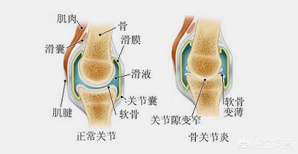 关节腔结构图图片