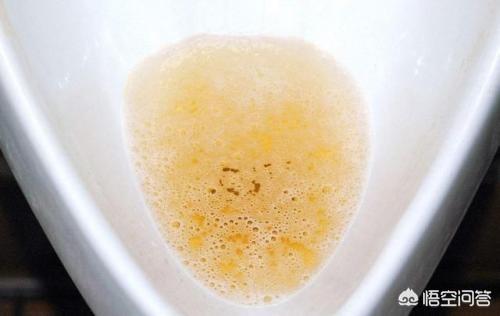 首先肯定的回答你:健康尿液是人体正常排泄物,大部分是水,还包含尿素