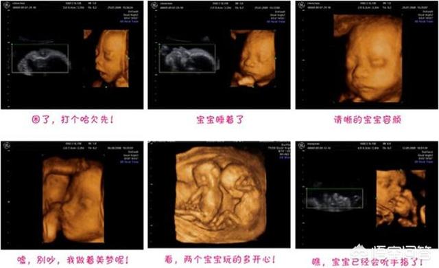 怀孕7个月四维彩超,七个月胎儿四维彩超图片