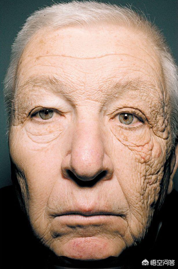 怎么才能去除皱纹怎么才能去除皱纹和黑眼圈