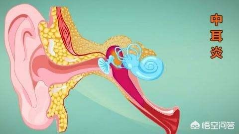 耳屎堵住耳朵自救方法，每天耳朵堵的厉害，怎么办就是耳朵不通气