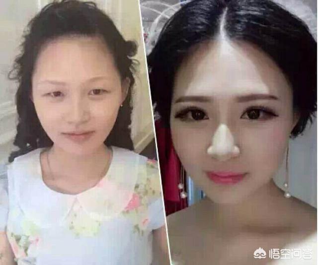 林妙可胸部:为什么有的女孩小时候长得丑，长大后会漂亮？
