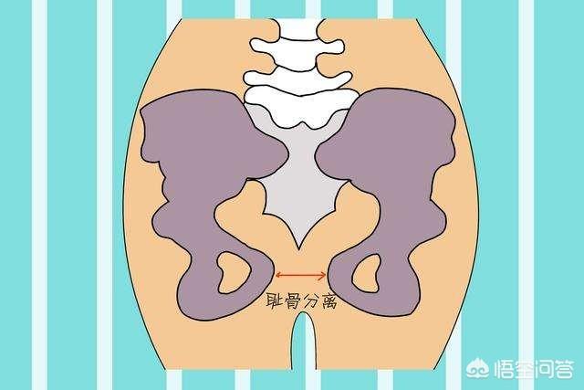 耻骨图片:耻骨图片位置图 怀孕后