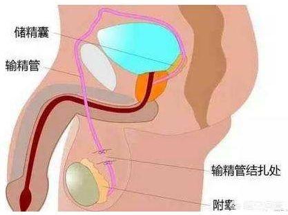 他因手术失败男性器官被毁，什么是男性结扎手术对男性身体有危害吗