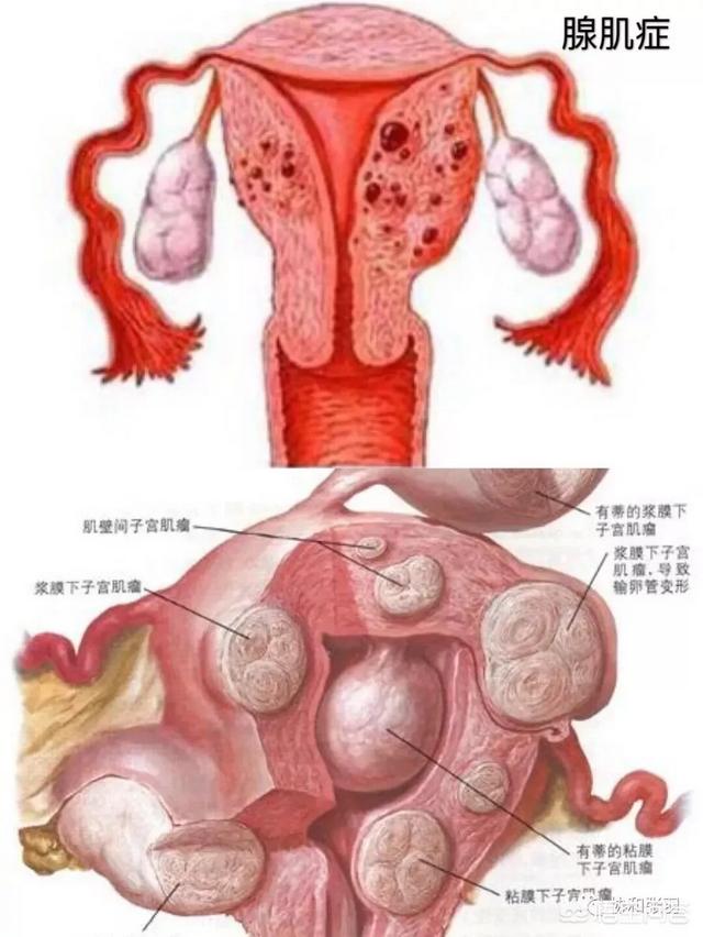 做了宫腔分离术后16天来月经正常吗:宫腔粘连分离术后多久可以来月经