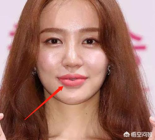 尹恩惠新剧:尹恩惠的脸是整容过度吗，你怎么看
