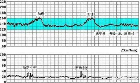 怀孕生男孩,胎心率是每分钟多少下？怀孕时应注意什么？