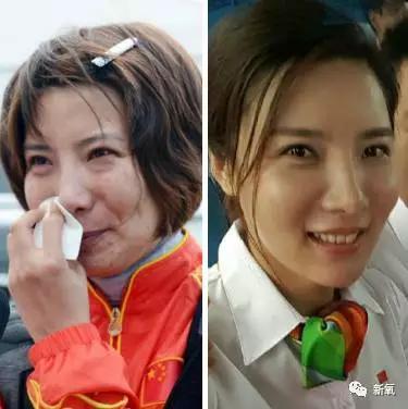 韩国明星整容失败:你们有没有见过或者听说过一些整容失败的案例？