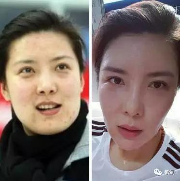 韩国明星整容失败:你们有没有见过或者听说过一些整容失败的案例？