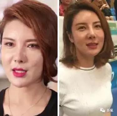韩国明星整容失败:你们有没有见过或者听说过一些整容失败的案例？