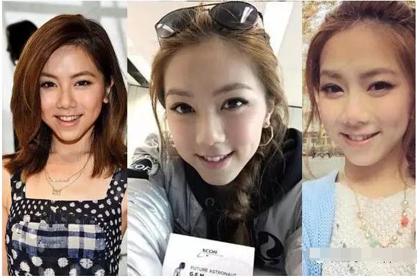 李金铭的胸:娱乐圈哪些女明星有“梨窝